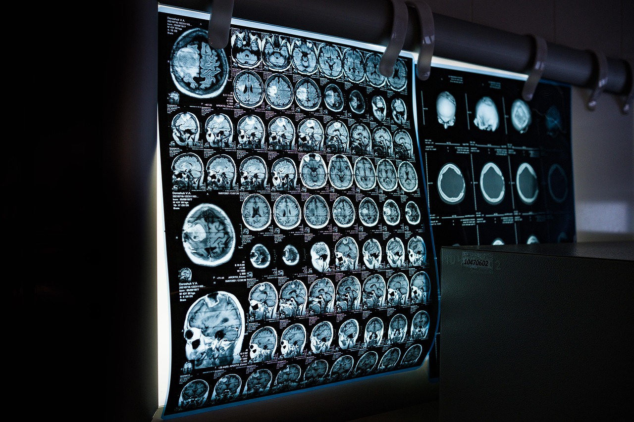 Brain Decoders Create a New Federal Evidence Problem