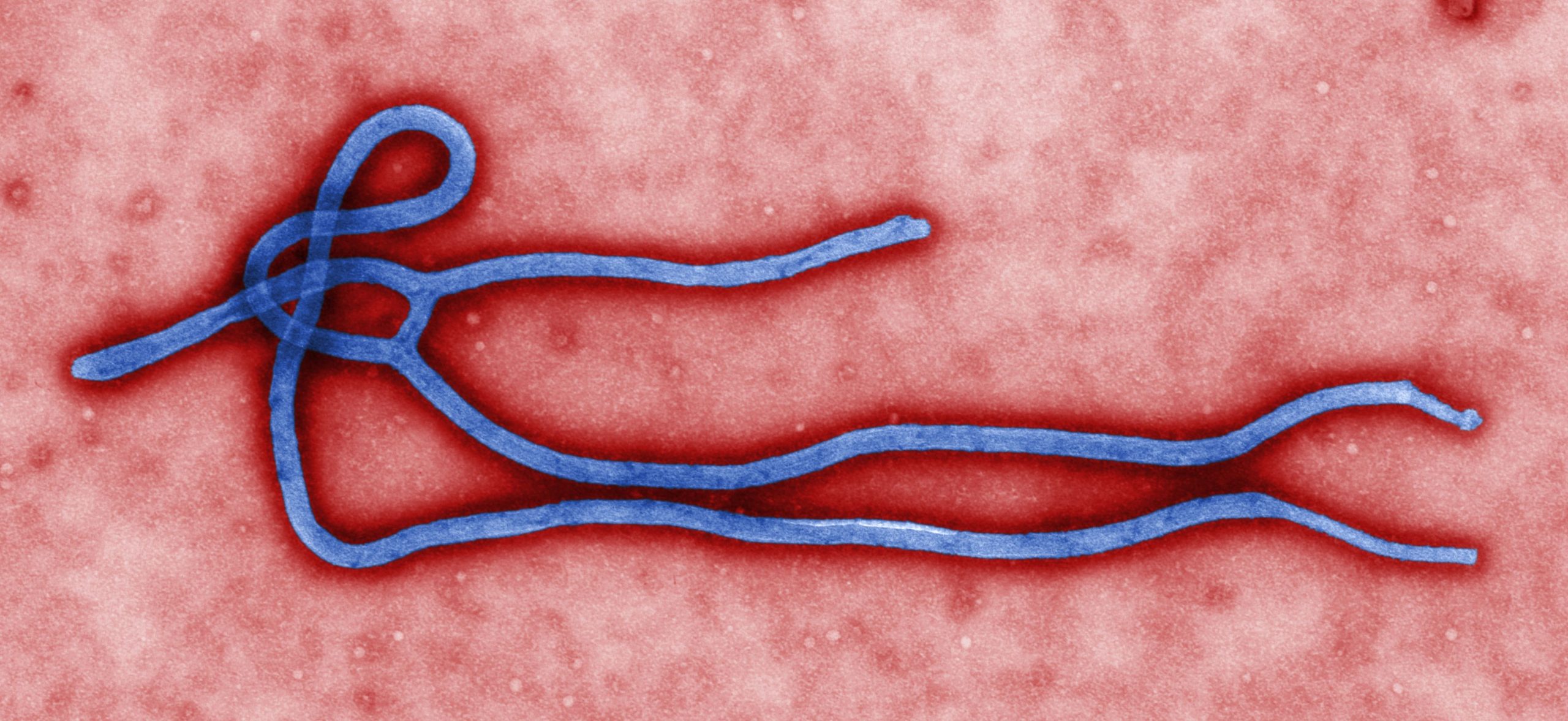 Kenya dispatch: health ministry confirms first imported Ebola virus case as fears and suspicions collide